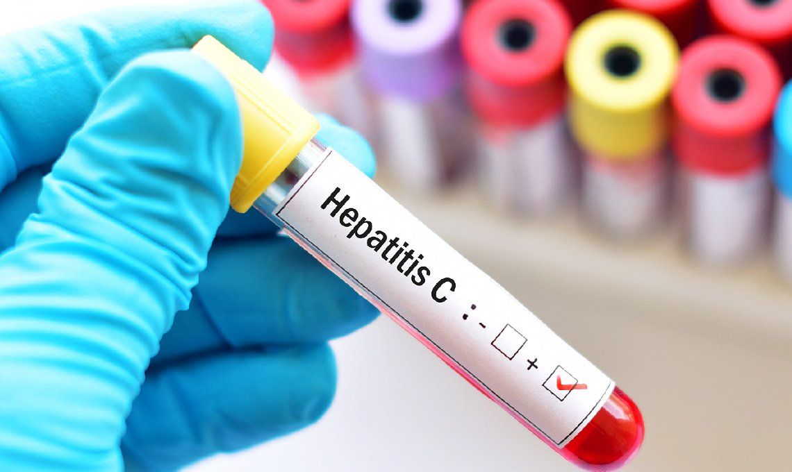 Hepatitis: qué es, cómo se transmite y cómo prevenir