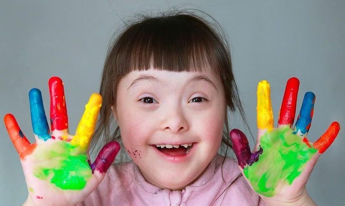 21 de marzo: Día Mundial de las Personas con Síndrome de Down
