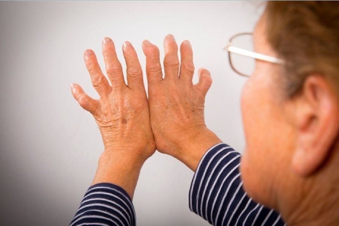 Artritis reumatoidea, buscando respuestas