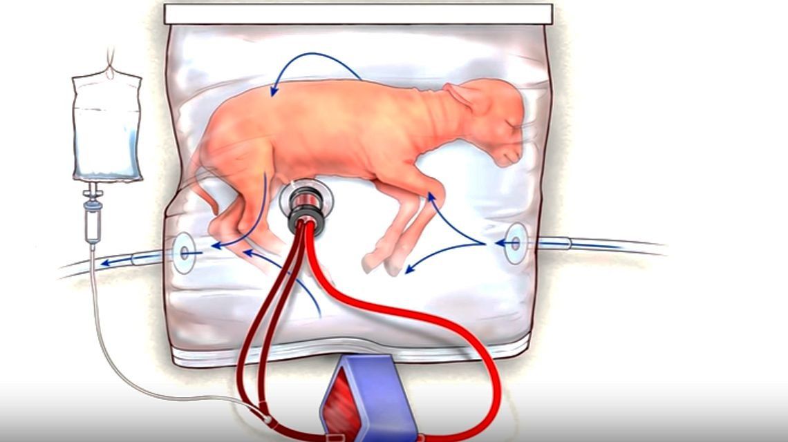 Crean un útero artificial que podría ayudar a bebés prematuros