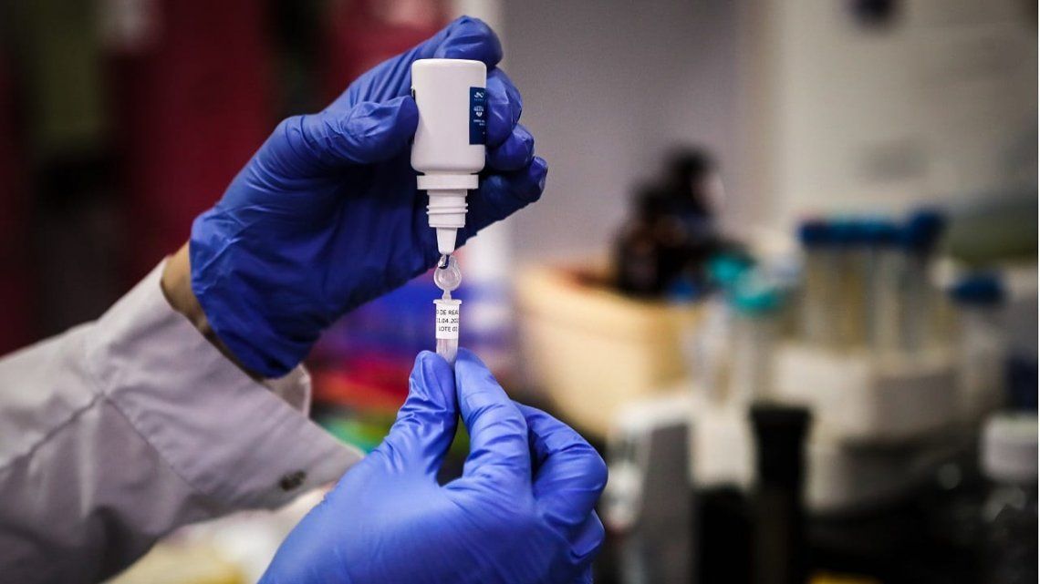 Esperanza: OMS informa que podrían haber millones de vacunas para coronavirus antes de fin de año