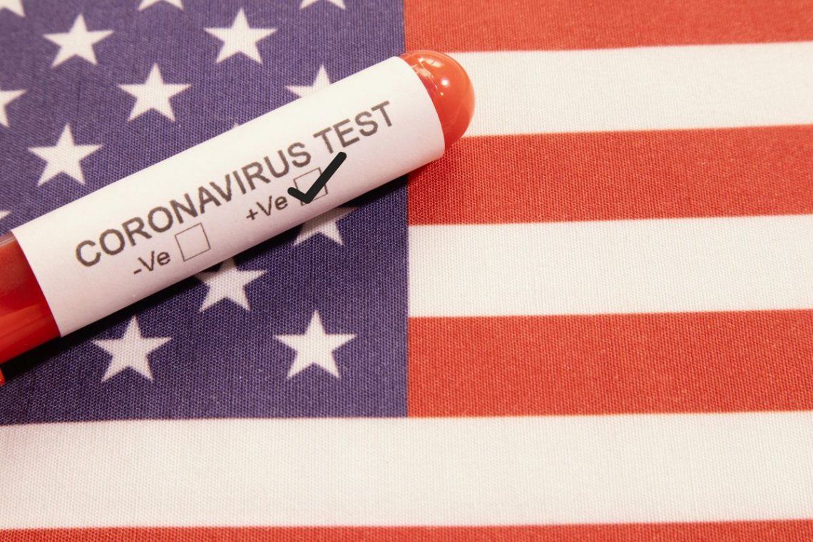 Coronavirus | EE.UU. bate récord mundial: más de un millón de casos en un día