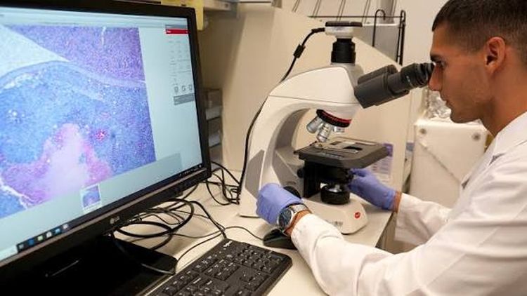 Cáncer de próstata: descubren 18 nuevas especies de bacterias en pacientes