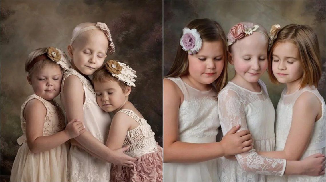 Tras curarse de cáncer estas nenas hacen una sesión de fotos anual