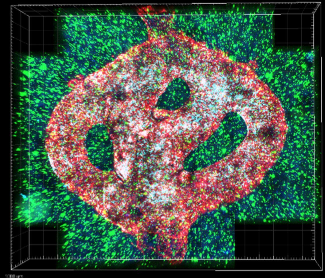 Israel: imagen microscópica del modelo de glioblastoma bioimpreso en 3D