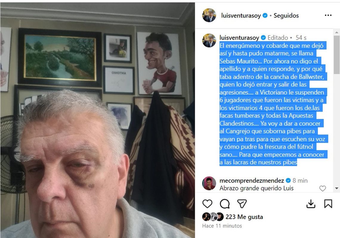 El posteo de Ventura mostrando el resultado de la agresión que sufrió, en su cuenta de Instagram. 