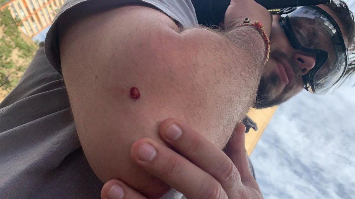 Chile: los carabineros hirieron con balas de goma al equipo periodístico de TN