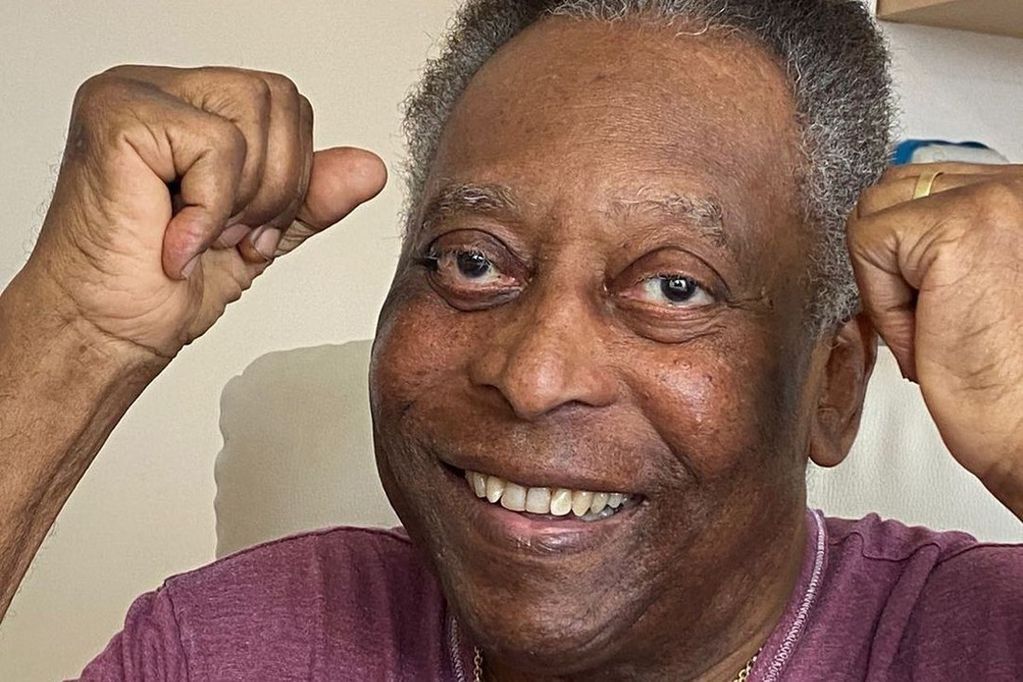 Pelé cumple 81 años
