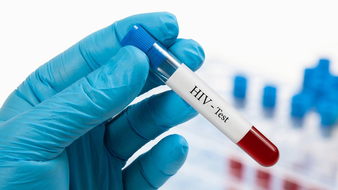 Los científicos están llevando a cabo la tarea titánica de curar el VIH en múltiples frentes.