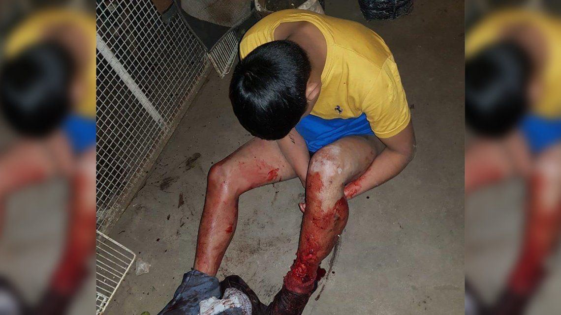 Mar del Plata: quiso robar en una casa, un perro lo atacó y terminó con una pierna destrozada