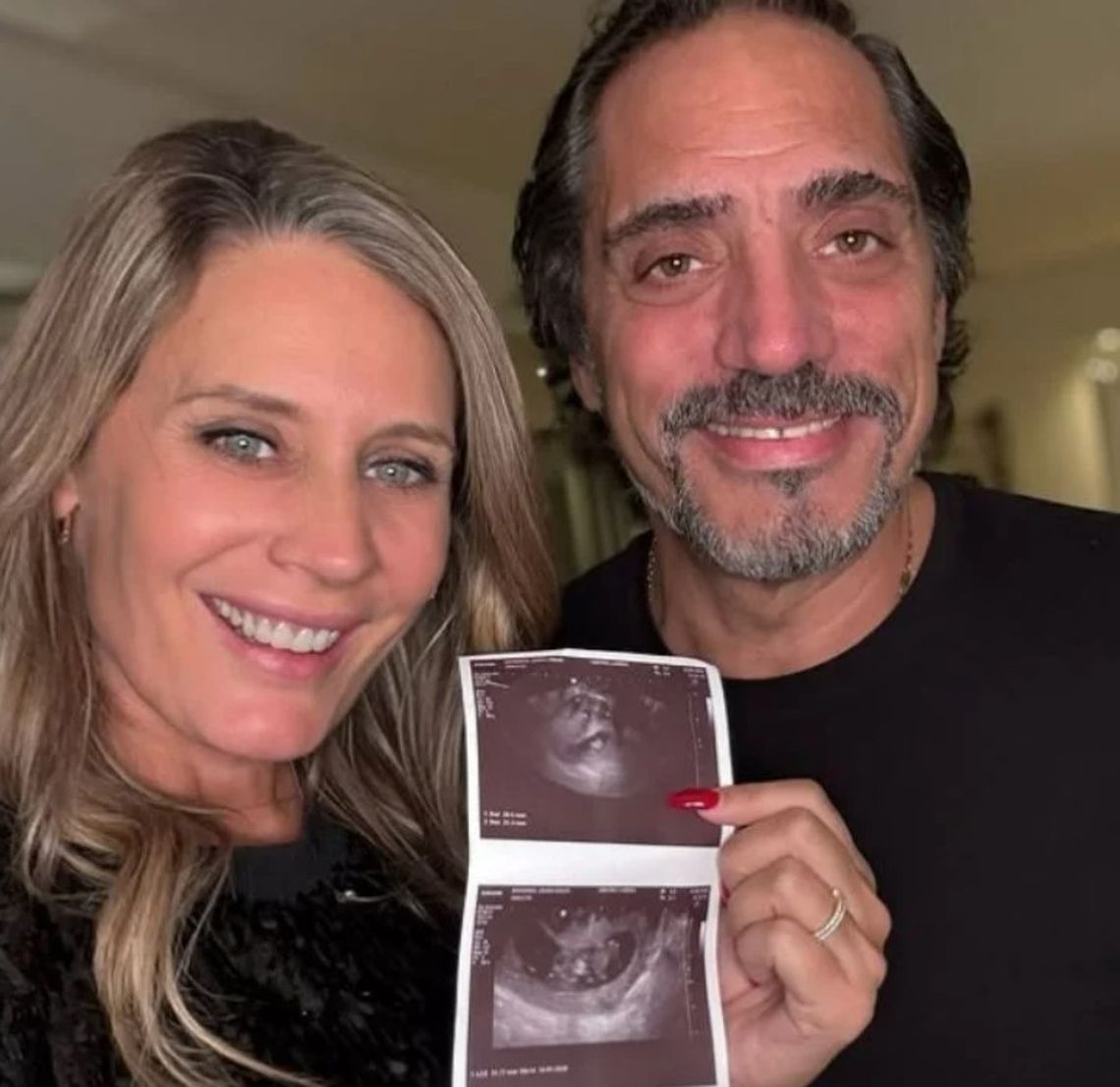 Rocío y Eduardo Fort serán padres en los próximos meses. 