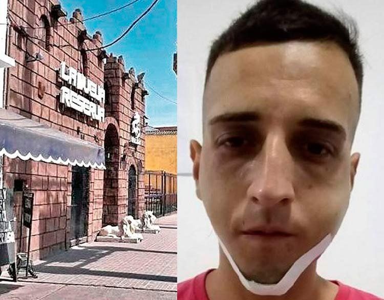 Longchamps | denuncian salvaje agresión de un patovica a un joven: le rompió la mandíbula en cuatro partes