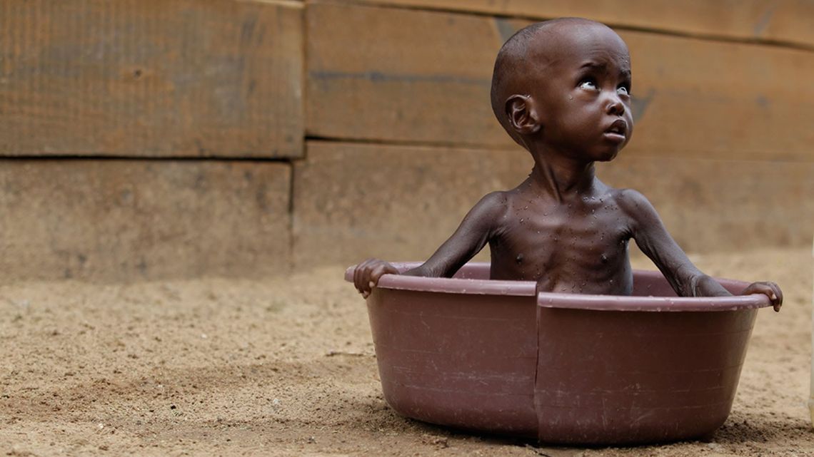 Cada cuatro segundos muere una persona por hambre.
