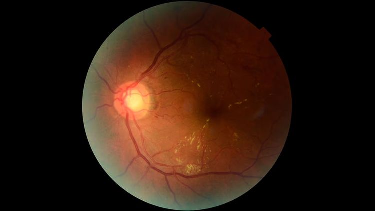 Una retina procesadas a través de Retinar. (FOTO: Conicet)