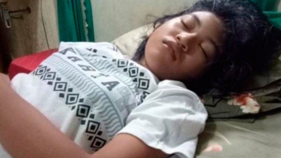 Síndrome de la bella durmiente: joven de Indonesia puede dormir 13 días seguidos