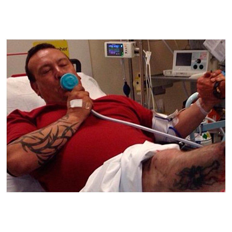 A este hombre casi lo mata el cigarrillo… electrónico