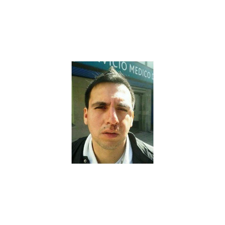 Brutal golpiza a un jugador profesional de futsal en Lanús