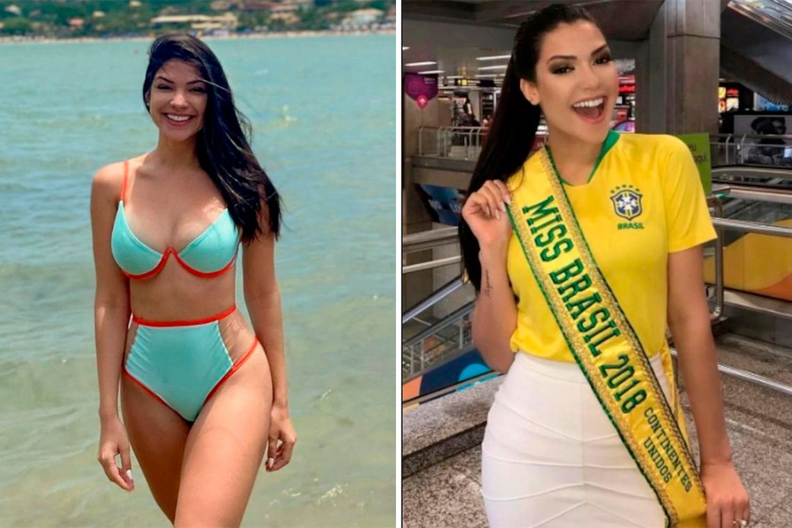 Murió una Miss Brasil que se operó de amígdalas y estuvo dos meses en coma