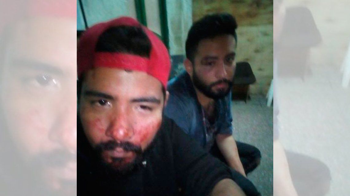 Brutal ataque homofóbico a una pareja en Quilmes